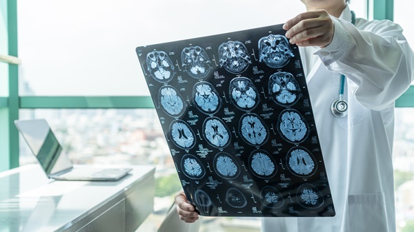A doctor in a white lab coat and stethoscope holds up a large sheet of MRI brain scans against the light of a window in a bright medical office. The sheet contains multiple cross-sectional views of a human brain.